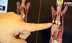 “Akciğer kanseri tedavisinde sağ kalım oranı artıyor"