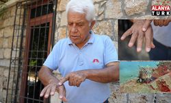 Su altında temizlik yaparken eline aslan balığı dikenleri batan profesörden sıcak sulu ilk müdahale uyarısı