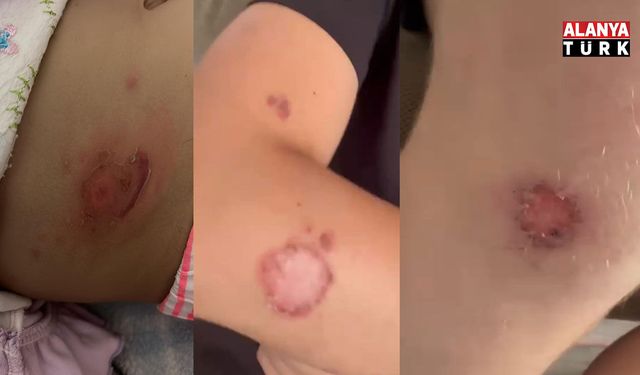 ALANYA’DA SİVRİSİNEK TEPKİSİ BÜYÜYOR; “Sorumlu Antalya mı, Alanya mı? Bu işin hesabını kim verecek?”