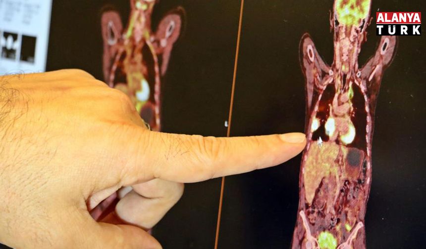 “Akciğer kanseri tedavisinde sağ kalım oranı artıyor"